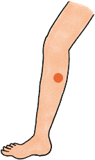 足（下肢）の主な注射部位 例③